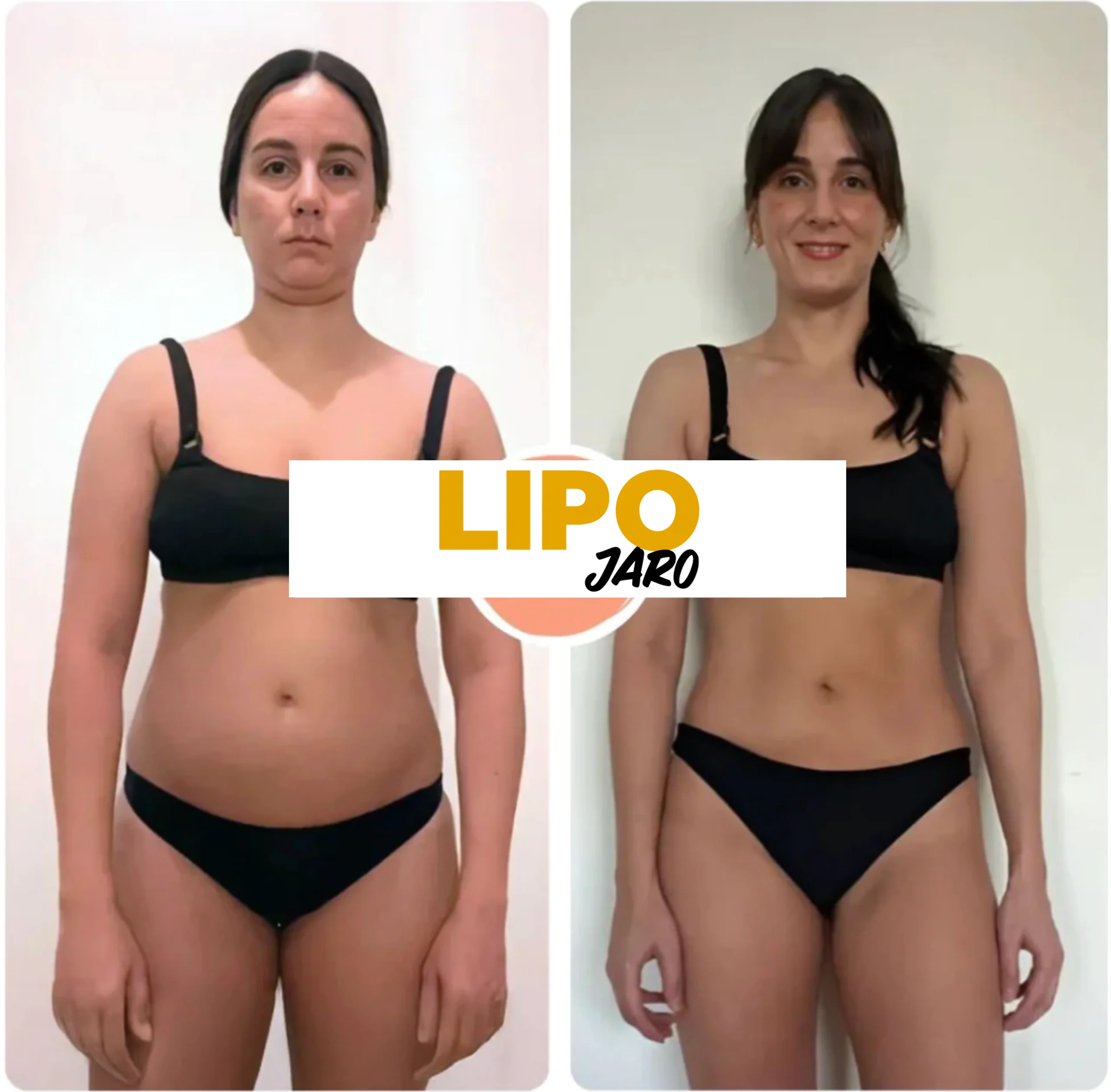 LipoJaro Nutzerin nimmt morgens eine Kapsel mit Wasser ein – Alltagsroutine